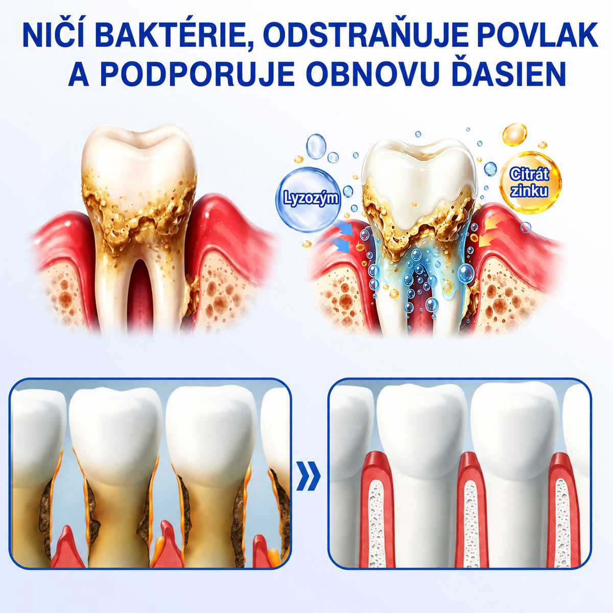 👨‍⚕️Evolvion® GumRevive regeneračný gél na parodont🦷