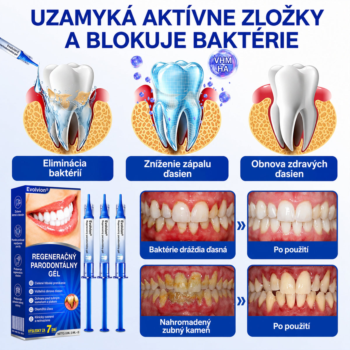 👨‍⚕️Evolvion® GumRevive regeneračný gél na parodont🦷
