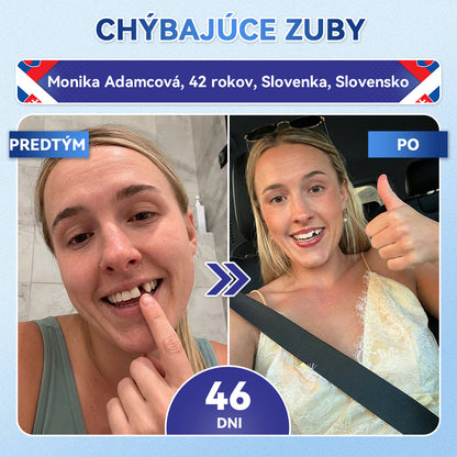 🦷 Glimmerly® TIDEGLUSIB ZUBY A ĎASNÁ Rýchlo rozpustné ústne pásiky Repair  | (🦷 Obnova skloviny a dentínu • Posilnenie ďasien • Odstránenie zubného kameňa a zápachu • Zastavenie citlivosti zubov) 3.0