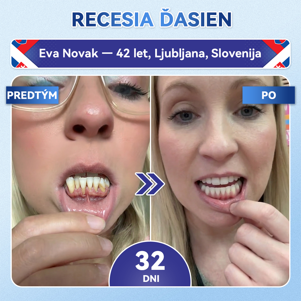 🦷 Glimmerly® TIDEGLUSIB ZUBY A ĎASNÁ Rýchlo rozpustné ústne pásiky Repair  | (🦷 Obnova skloviny a dentínu • Posilnenie ďasien • Odstránenie zubného kameňa a zápachu • Zastavenie citlivosti zubov) 3.0