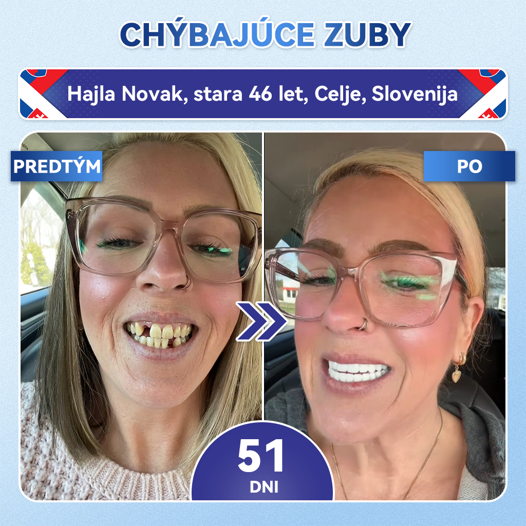 🦷 Glimmerly® TIDEGLUSIB ZUBY A ĎASNÁ Rýchlo rozpustné ústne pásiky Repair  | (🦷 Obnova skloviny a dentínu • Posilnenie ďasien • Odstránenie zubného kameňa a zápachu • Zastavenie citlivosti zubov) 3.0