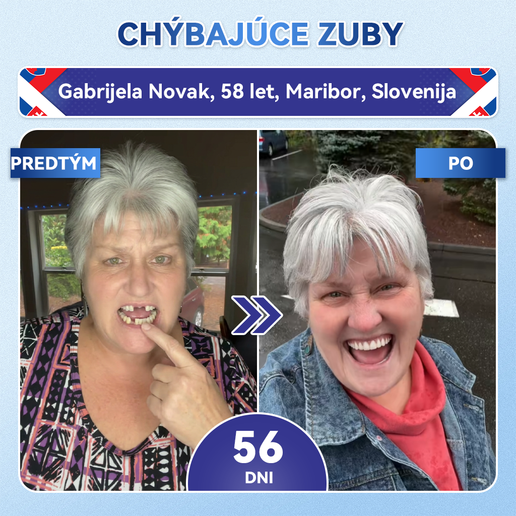 🦷 Glimmerly® TIDEGLUSIB ZUBY A ĎASNÁ Rýchlo rozpustné ústne pásiky Repair  | (🦷 Obnova skloviny a dentínu • Posilnenie ďasien • Odstránenie zubného kameňa a zápachu • Zastavenie citlivosti zubov) 3.0