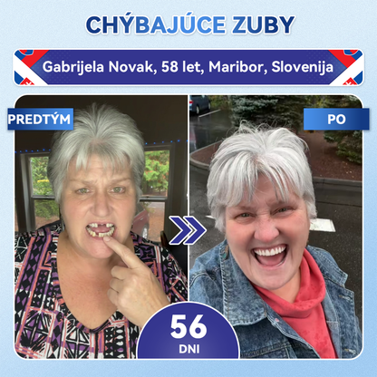 🦷 Glimmerly® TIDEGLUSIB ZUBY A ĎASNÁ Rýchlo rozpustné ústne pásiky Repair  | (🦷 Obnova skloviny a dentínu • Posilnenie ďasien • Odstránenie zubného kameňa a zápachu • Zastavenie citlivosti zubov) 3.0