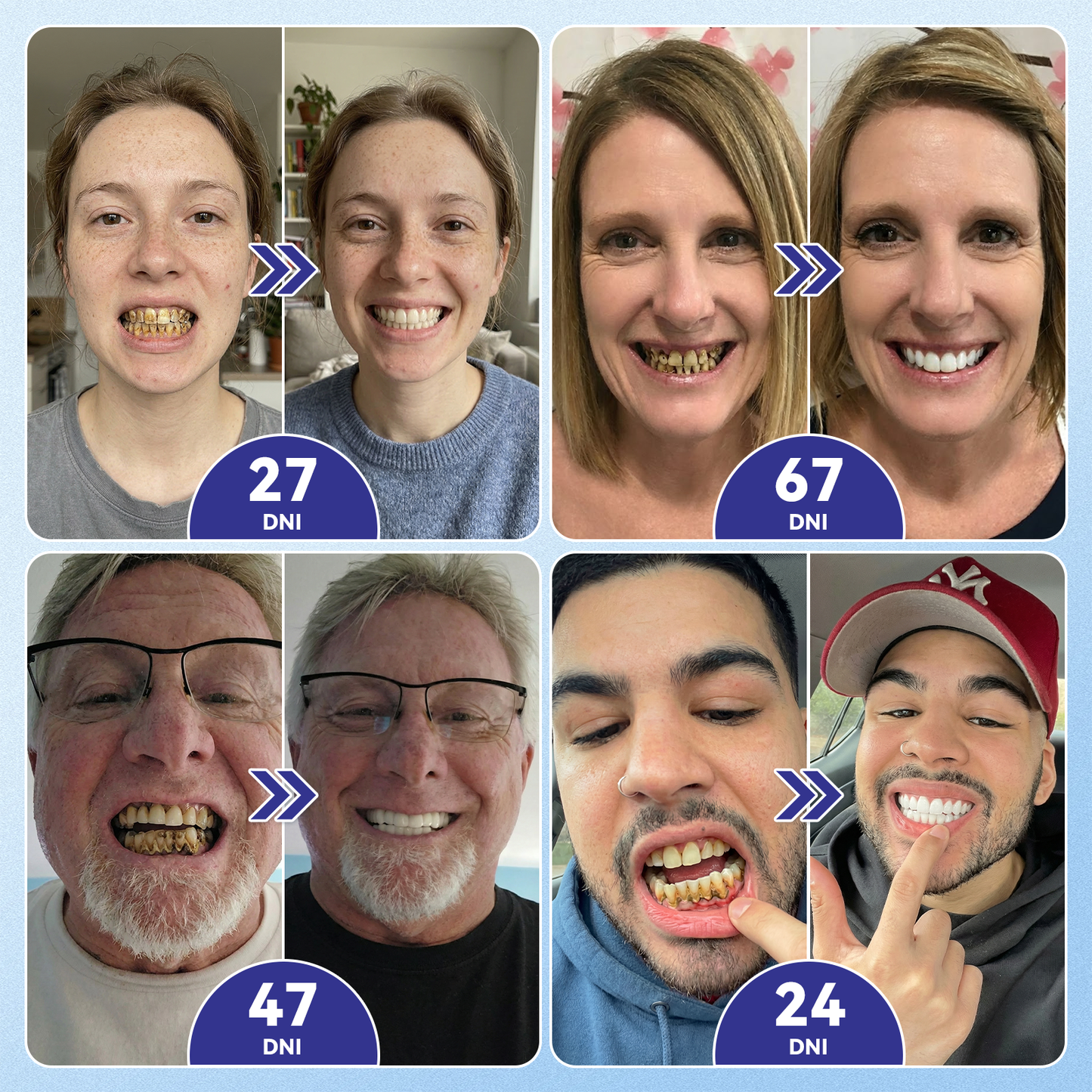 🦷 Glimmerly® TIDEGLUSIB ZUBY A ĎASNÁ Rýchlo rozpustné ústne pásiky Repair  | (🦷 Obnova skloviny a dentínu • Posilnenie ďasien • Odstránenie zubného kameňa a zápachu • Zastavenie citlivosti zubov) 3.0