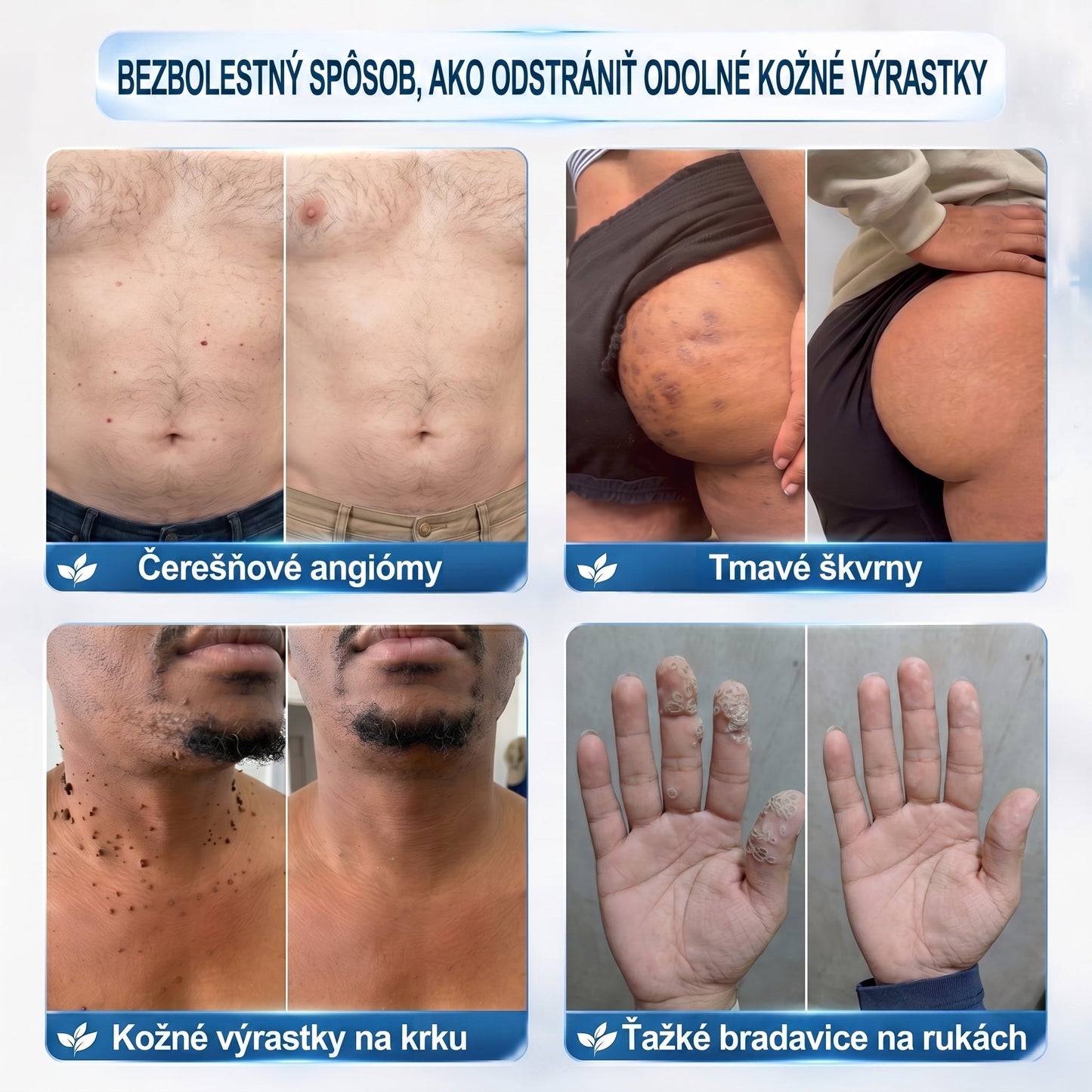 𝐏𝒊𝐜𝐝𝒐® 🌿🌿 7-𝑫ň𝒐𝒗ý 𝑵𝒂 𝑶𝒅𝒔𝒕𝒓𝒂ň𝒐𝒗𝒂𝒏𝒊𝒆 𝑷𝒊𝒈𝒎𝒆𝒏𝒕𝒐𝒗ý𝒄𝒉 Š𝒌𝒗ŕ𝒏 𝑨 𝑱𝒂𝒛𝒊𝒆𝒗 𝑷𝒆𝒓𝒐(𝐵𝑒𝑧 𝑏𝑜𝑙𝑒𝑠𝑡𝑖, 𝑏𝑒𝑧 𝑗𝑎𝑧𝑖𝑒𝑣 – 𝑟𝑜𝑙𝑙𝑒𝑟𝑏𝑎𝑙𝑙)💪