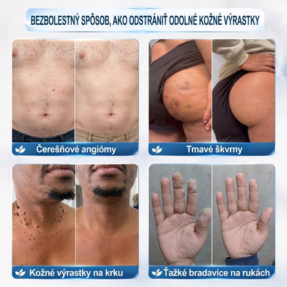 𝐏𝒊𝐜𝐝𝒐® 🌿🌿 7-𝑫ň𝒐𝒗ý 𝑵𝒂 𝑶𝒅𝒔𝒕𝒓𝒂ň𝒐𝒗𝒂𝒏𝒊𝒆 𝑷𝒊𝒈𝒎𝒆𝒏𝒕𝒐𝒗ý𝒄𝒉 Š𝒌𝒗ŕ𝒏 𝑨 𝑱𝒂𝒛𝒊𝒆𝒗 𝑷𝒆𝒓𝒐(𝐵𝑒𝑧 𝑏𝑜𝑙𝑒𝑠𝑡𝑖, 𝑏𝑒𝑧 𝑗𝑎𝑧𝑖𝑒𝑣 – 𝑟𝑜𝑙𝑙𝑒𝑟𝑏𝑎𝑙𝑙)💪