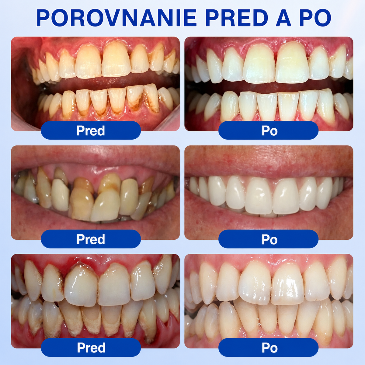 👨‍⚕️Evolvion® GumRevive regeneračný gél na parodont🦷