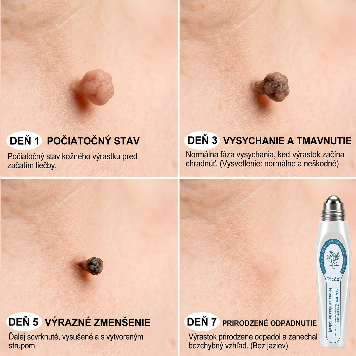 𝐏𝒊𝐜𝐝𝒐® 🌿🌿 7-𝑫ň𝒐𝒗ý 𝑵𝒂 𝑶𝒅𝒔𝒕𝒓𝒂ň𝒐𝒗𝒂𝒏𝒊𝒆 𝑷𝒊𝒈𝒎𝒆𝒏𝒕𝒐𝒗ý𝒄𝒉 Š𝒌𝒗ŕ𝒏 𝑨 𝑱𝒂𝒛𝒊𝒆𝒗 𝑷𝒆𝒓𝒐(𝐵𝑒𝑧 𝑏𝑜𝑙𝑒𝑠𝑡𝑖, 𝑏𝑒𝑧 𝑗𝑎𝑧𝑖𝑒𝑣 – 𝑟𝑜𝑙𝑙𝑒𝑟𝑏𝑎𝑙𝑙)💪