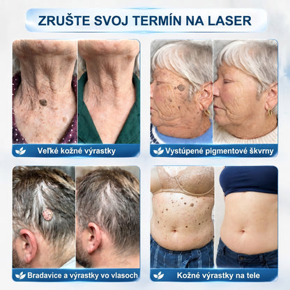 𝐏𝒊𝐜𝐝𝒐® 🌿🌿 7-𝑫ň𝒐𝒗ý 𝑵𝒂 𝑶𝒅𝒔𝒕𝒓𝒂ň𝒐𝒗𝒂𝒏𝒊𝒆 𝑷𝒊𝒈𝒎𝒆𝒏𝒕𝒐𝒗ý𝒄𝒉 Š𝒌𝒗ŕ𝒏 𝑨 𝑱𝒂𝒛𝒊𝒆𝒗 𝑷𝒆𝒓𝒐(𝐵𝑒𝑧 𝑏𝑜𝑙𝑒𝑠𝑡𝑖, 𝑏𝑒𝑧 𝑗𝑎𝑧𝑖𝑒𝑣 – 𝑟𝑜𝑙𝑙𝑒𝑟𝑏𝑎𝑙𝑙)💪